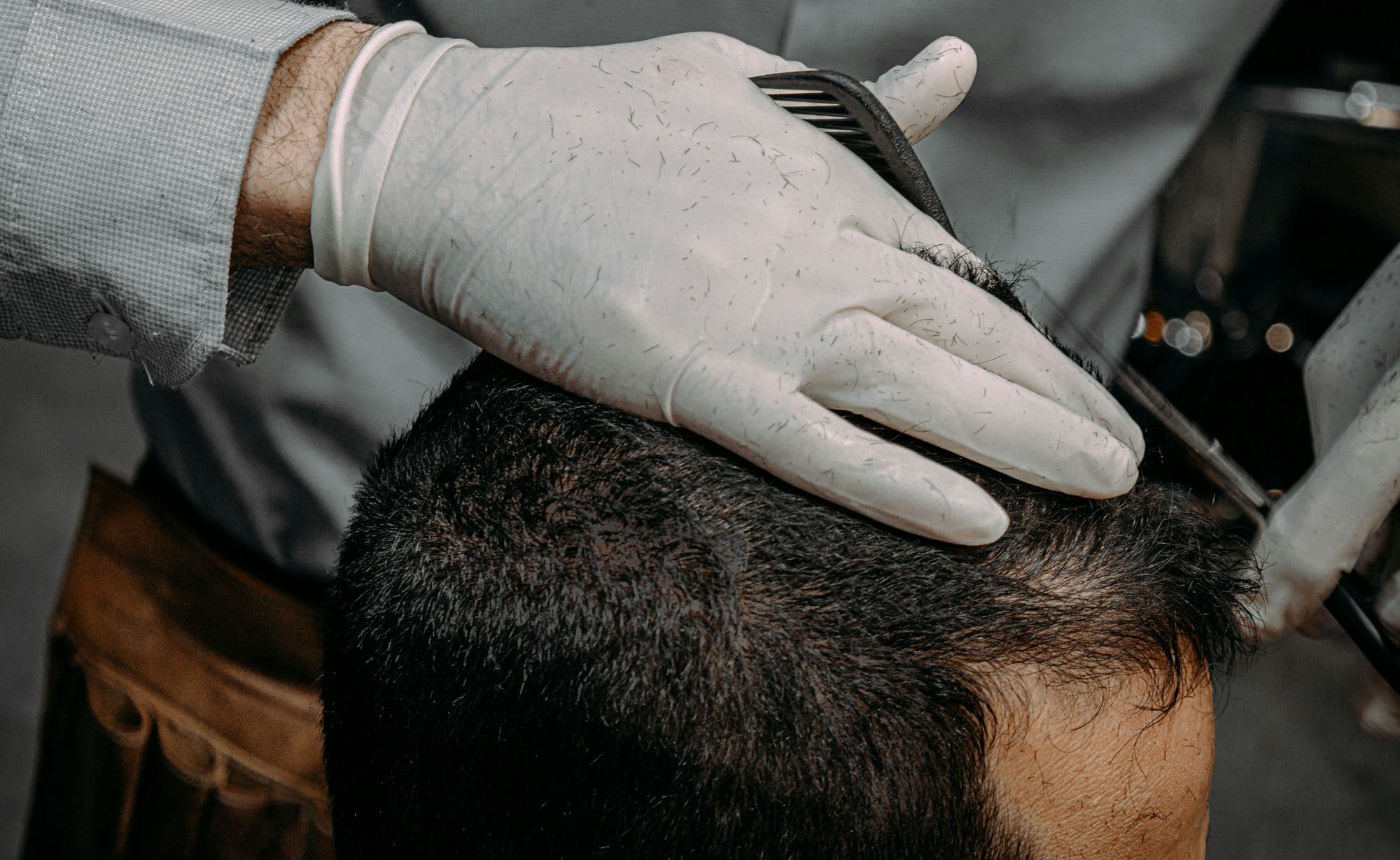 A clinician examining a man’s hair